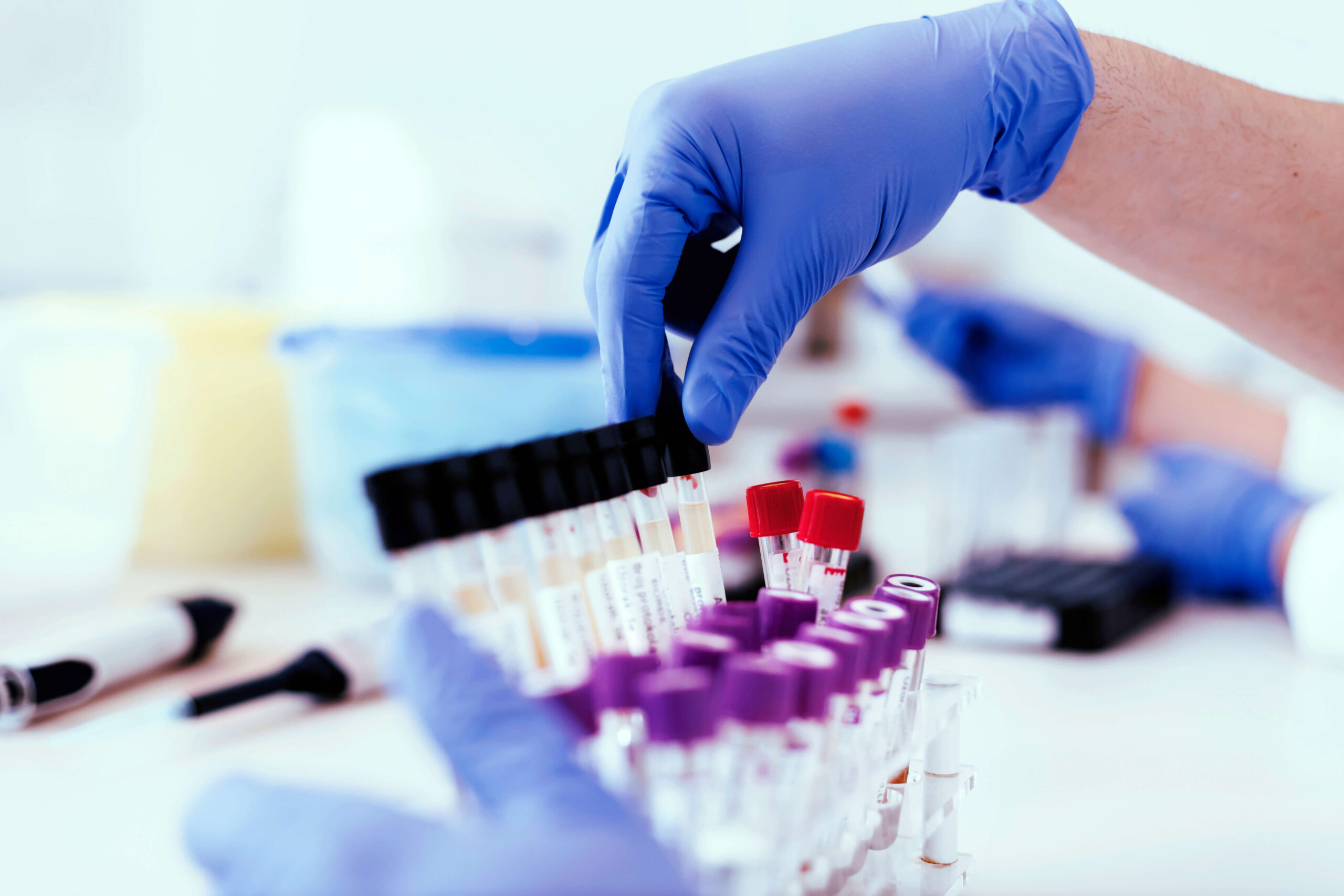Research Chemical Cannabinoid For Sale – Ensure Safe Research Practices